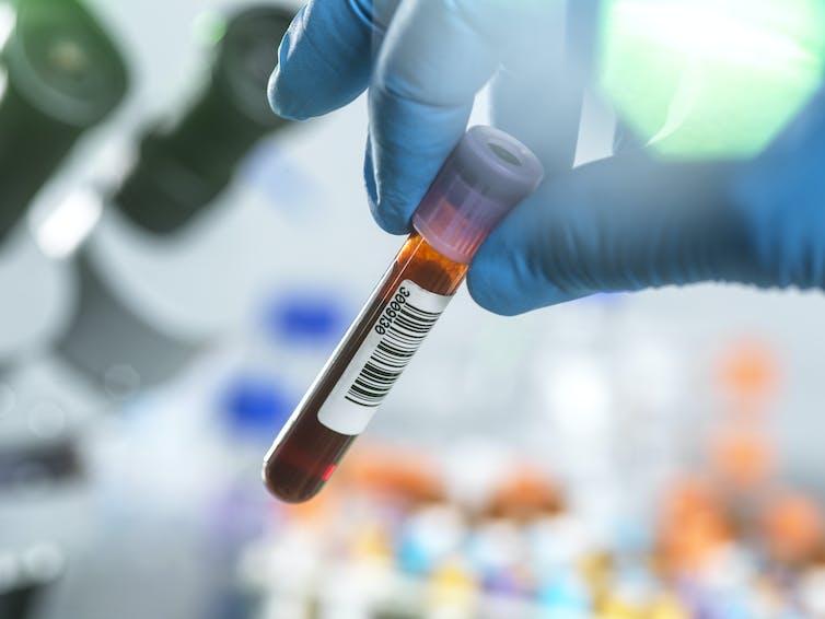A blood test that screens for multiple cancers at once promises to boost early detection